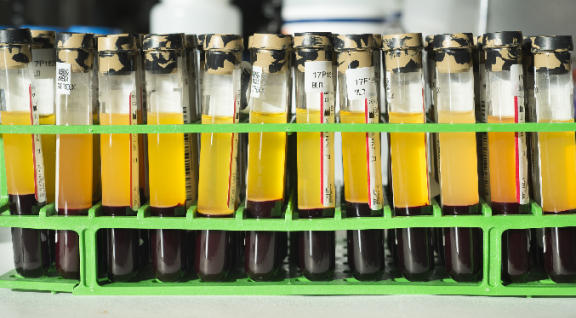 Buisjes met bloed in een standaard