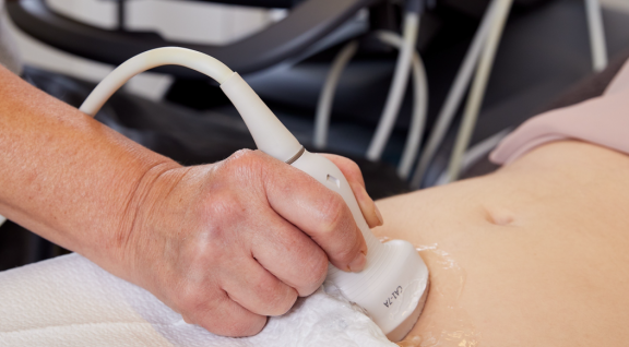 Een echoscopist beweegt het echoapparaat over de buik van een zwangere voor een echoscopie bij 13 weken